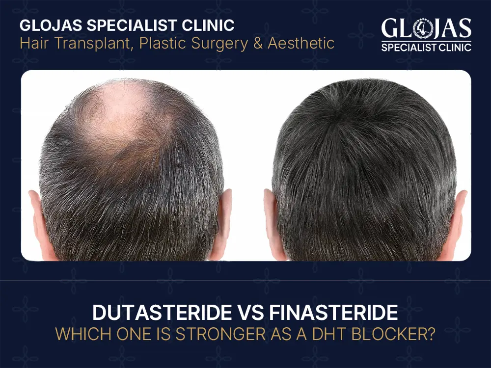 Dutasteride vs Finasteride: Which One Is Stronger as a DHT Blocker? 3 Dutasteride vs Finasteride