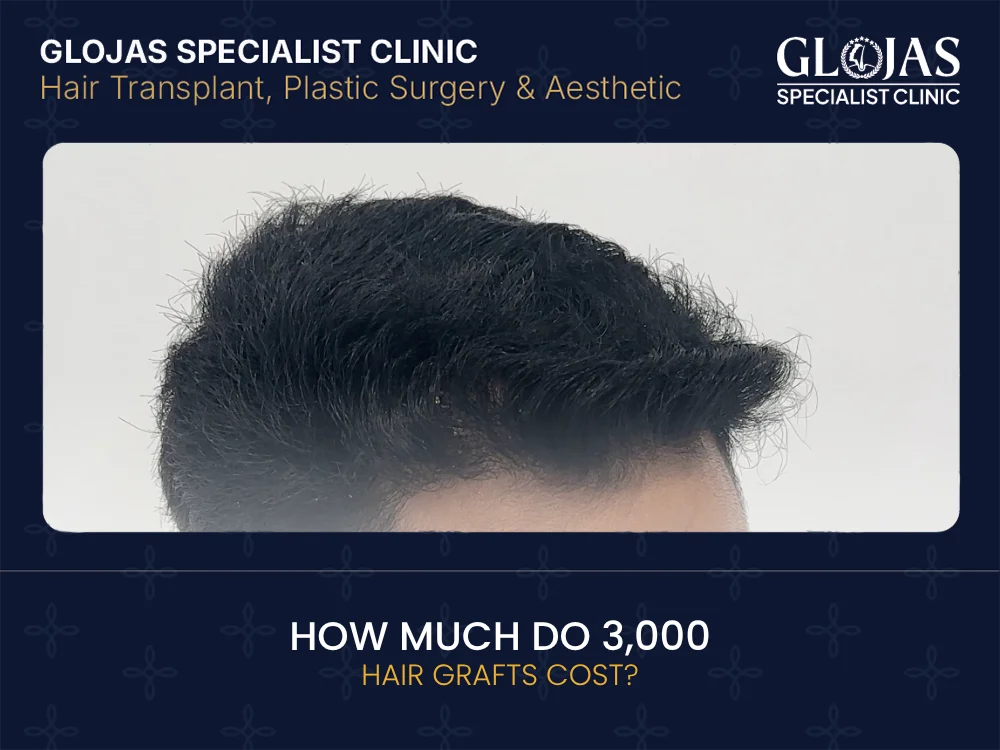 hair-grafts-cost