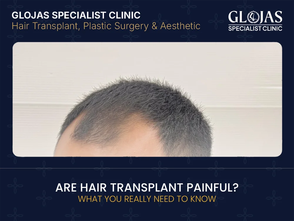 hair-transplant-painful