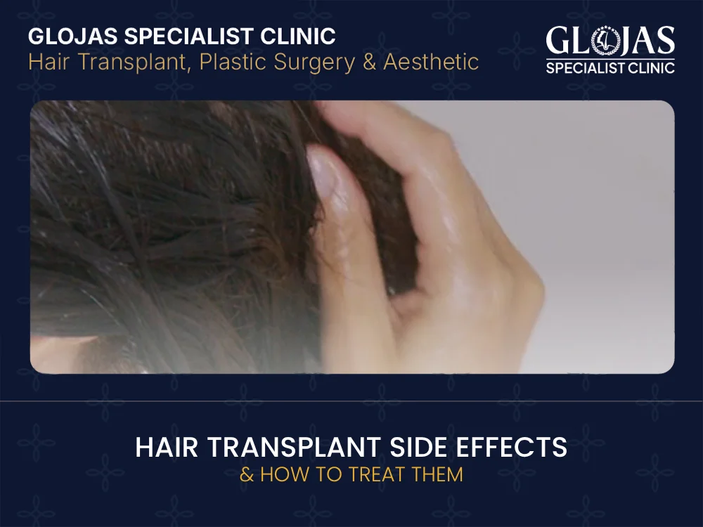 hair-transplant-side-effects