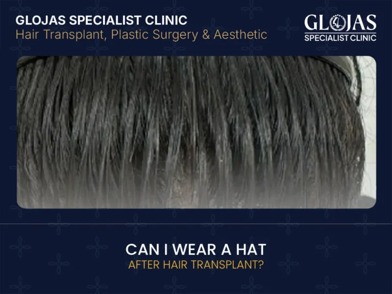 hat-after-hair-transplant
