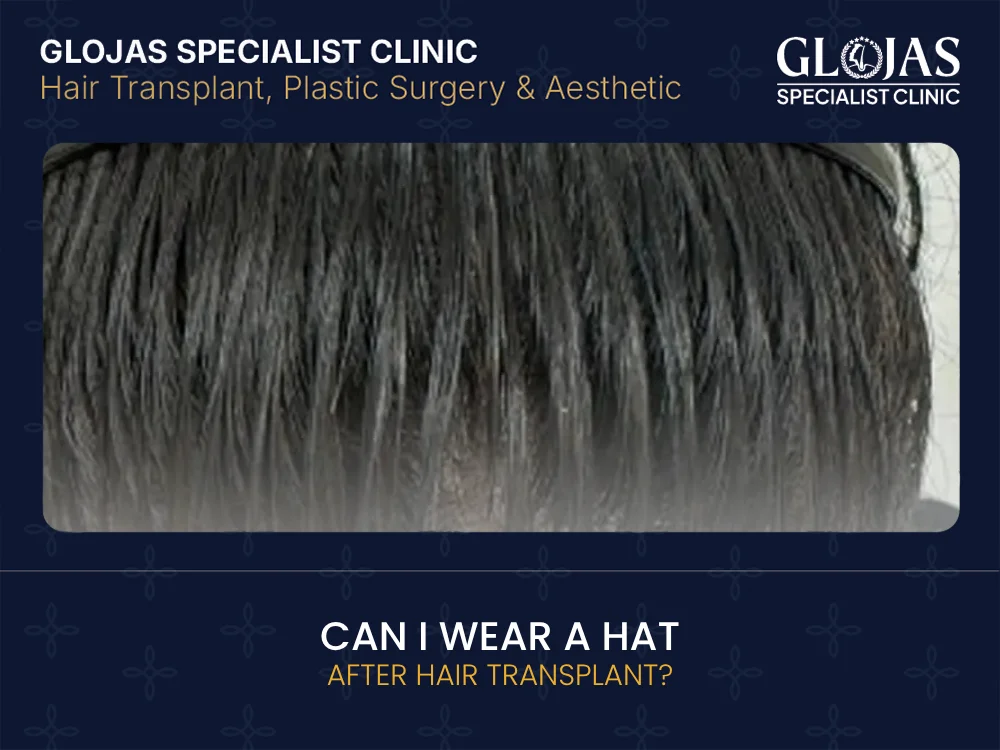 hat-after-hair-transplant