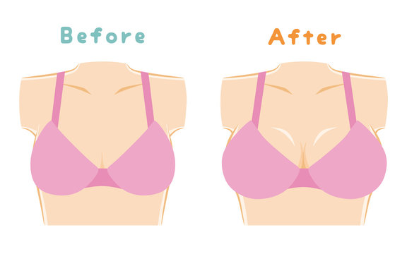 small-breasts-malaysia