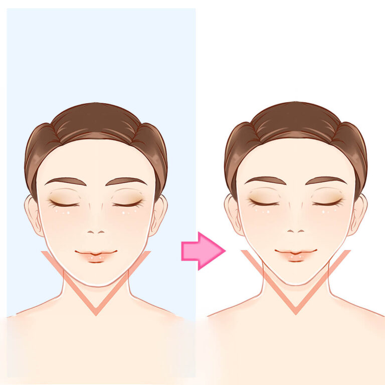 V Shape Face Treatment 1 v shape face