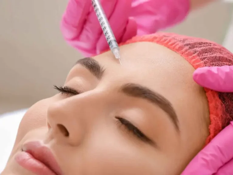 V Shape Face Treatment 3 botox-v-shape
