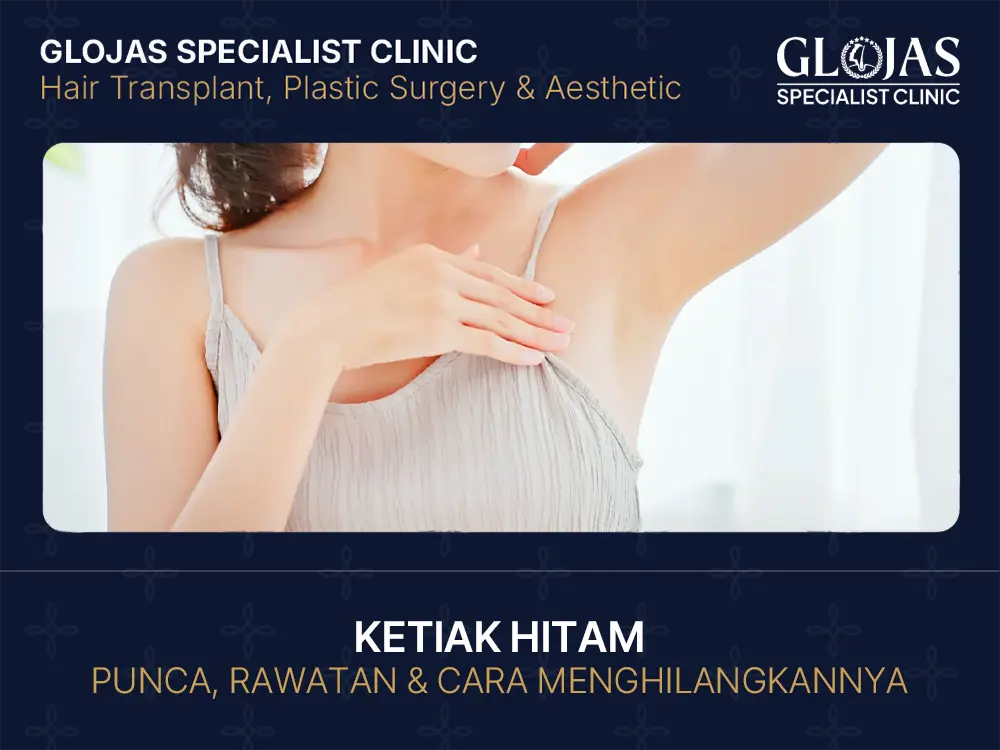 Ketiak Hitam: Punca, Rawatan & Cara Menghilangkannya