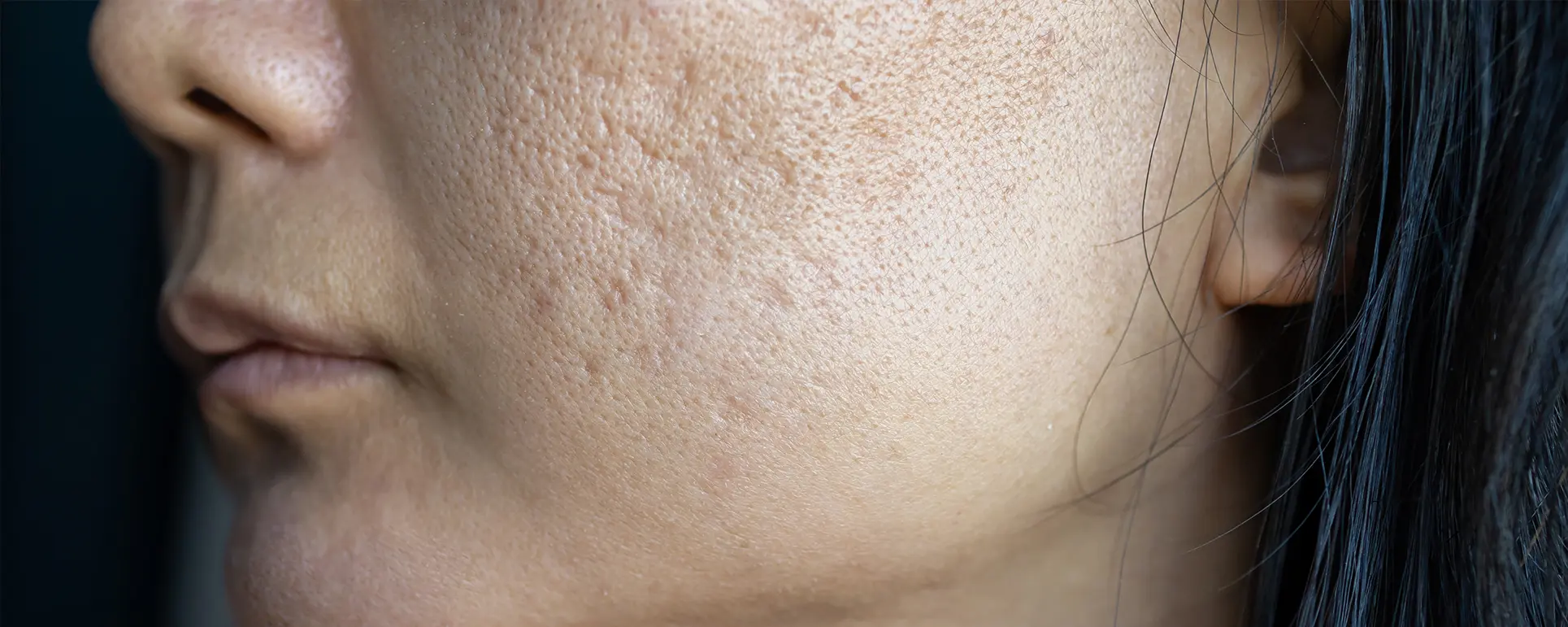 liang-pori-muka-wajah