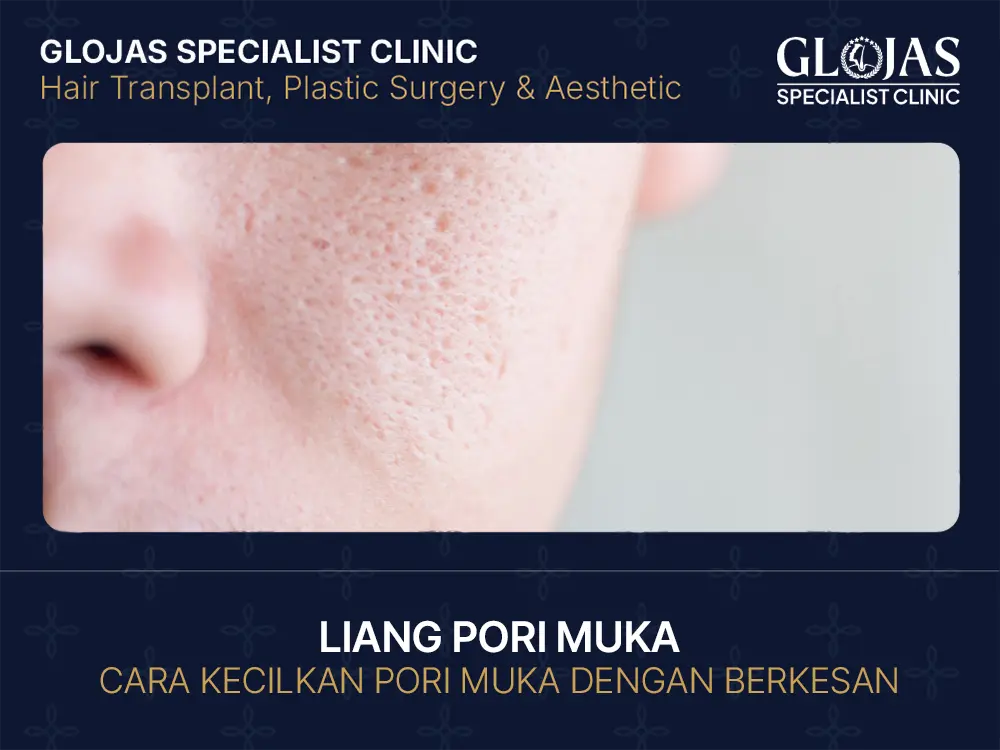 Liang Pori Muka: Cara Kecilkan Pori Muka Dengan Berkesan (2025)