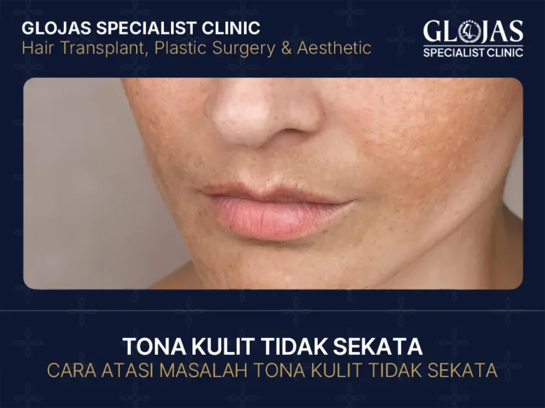 tona-kulit-tidak-sekata