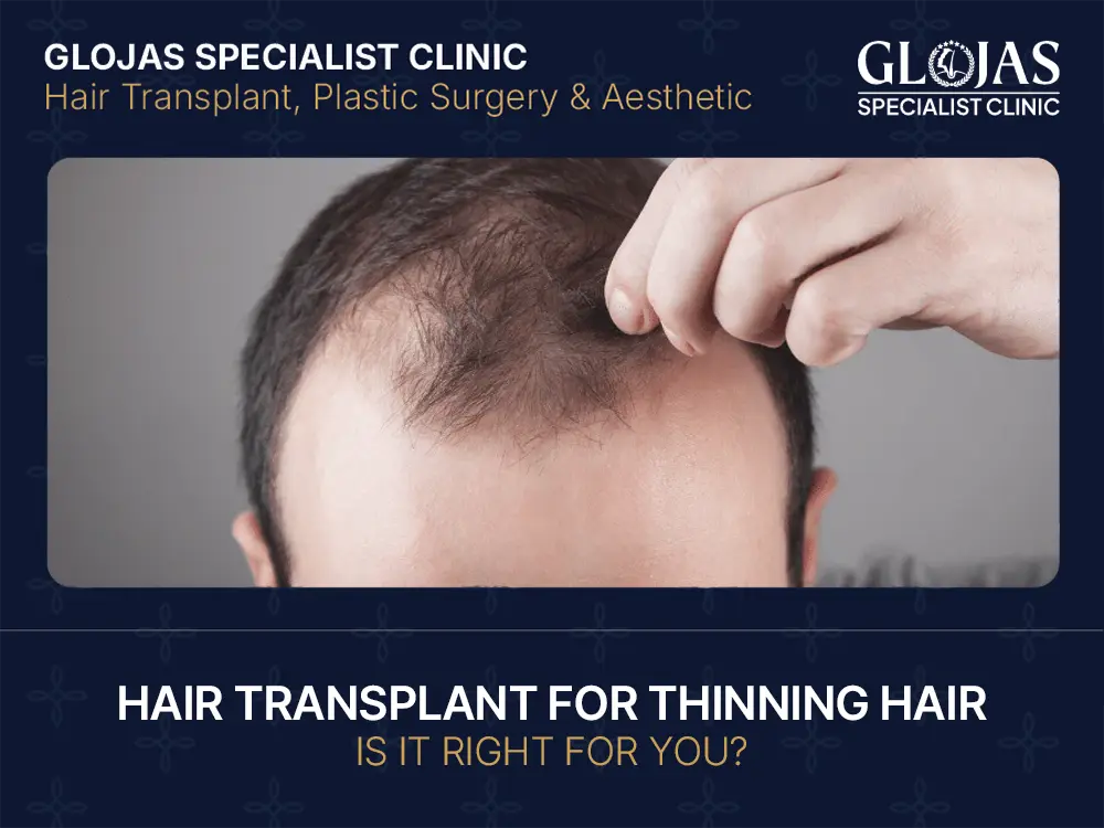Hair Transplant for Thinning Hair