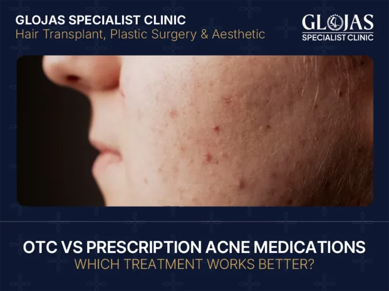 acne medications comparison