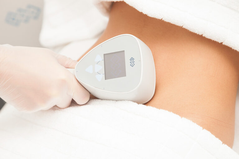 exilis 360 skin tightening