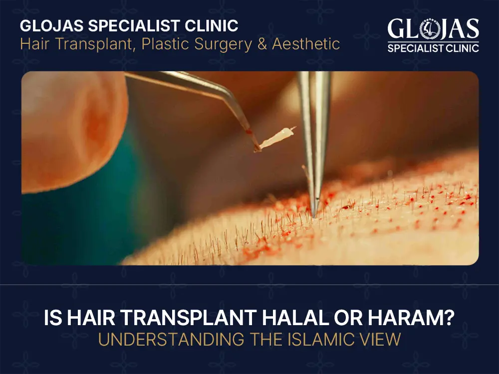 is hair transplant halal or haram