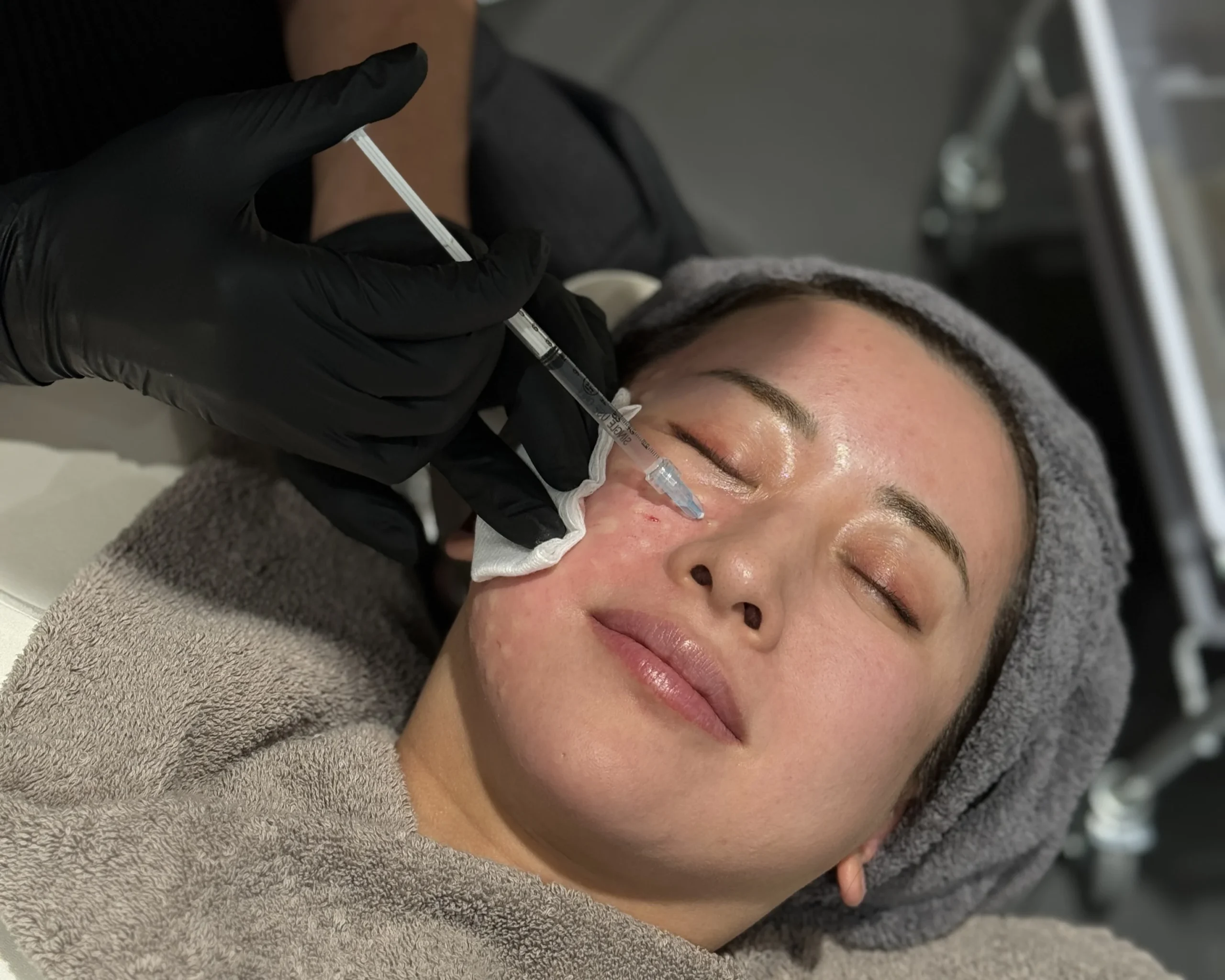 rejuran healer faqs on women face