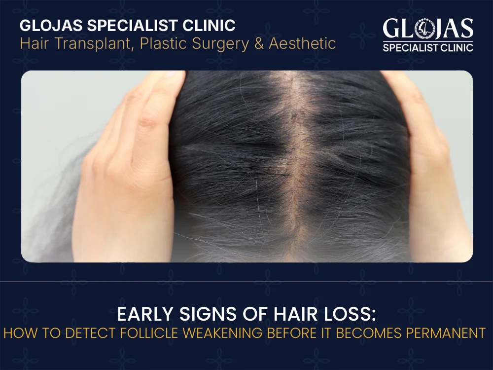 signs-of-hair-loss