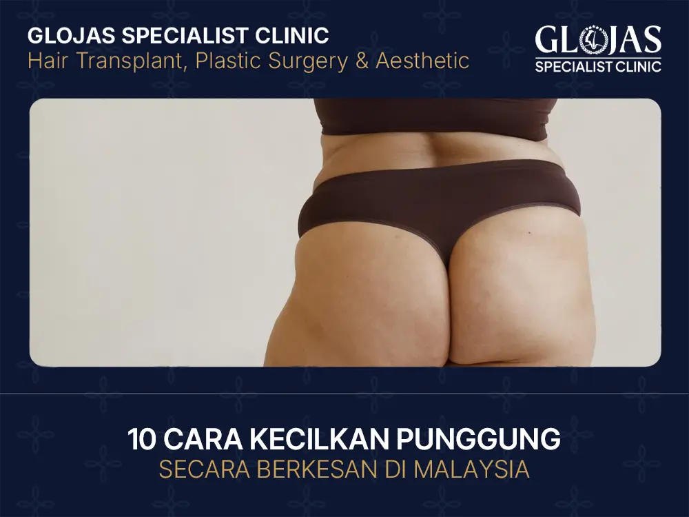 10 Cara Kecilkan Punggung Secara Berkesan