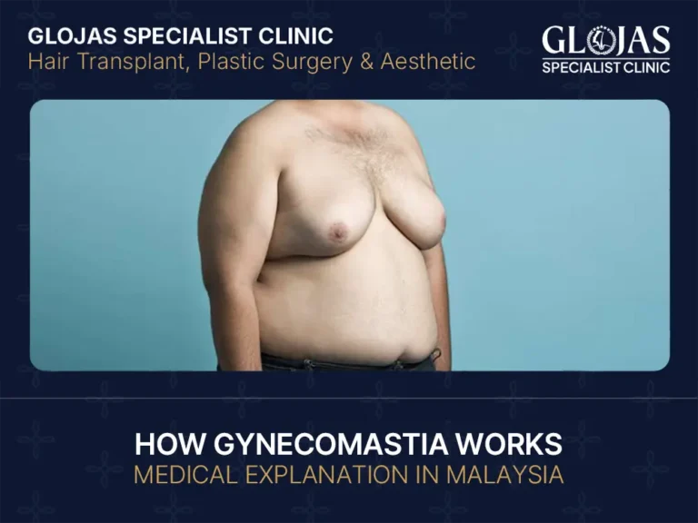 How Gynecomastia Works