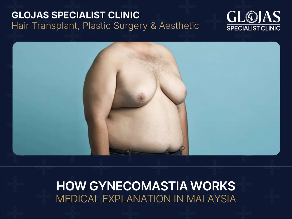 How Gynecomastia Works: Medical Explanation in Malaysia 10 How Gynecomastia Works