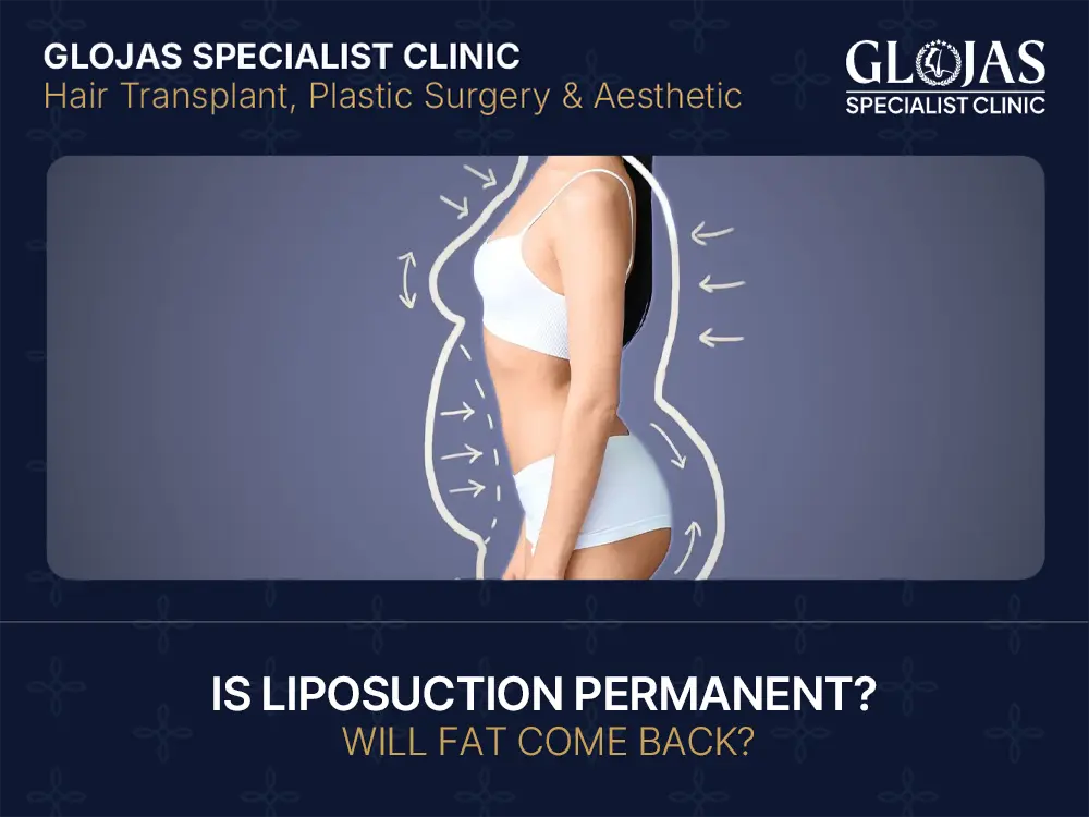 Blogs 26 Is Liposuction Permanent