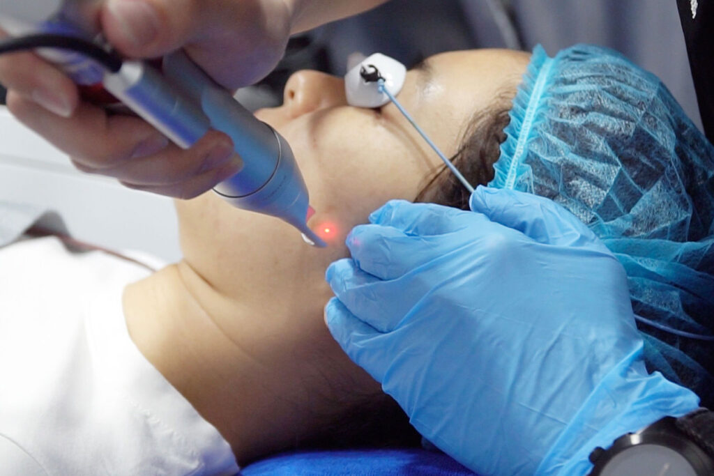 Pico Laser Treatment for Pigmentation & Skin Rejuvenation