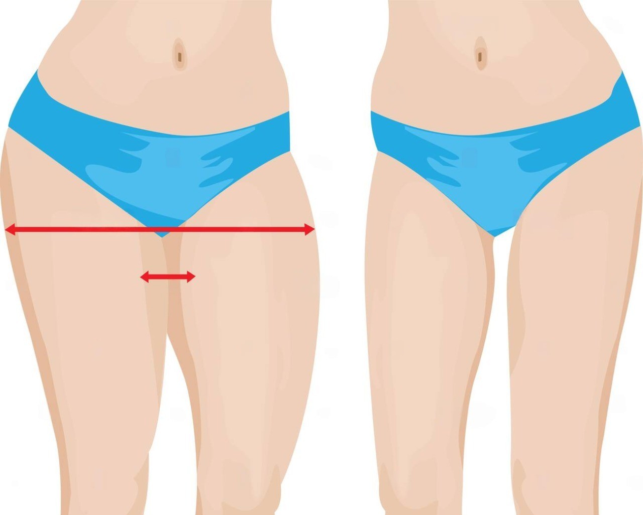 10 Cara Kecilkan Punggung Secara Berkesan di Malaysia 1 10 Cara Kecilkan Punggung & Pinggul dengan Cepat (Berkesan)