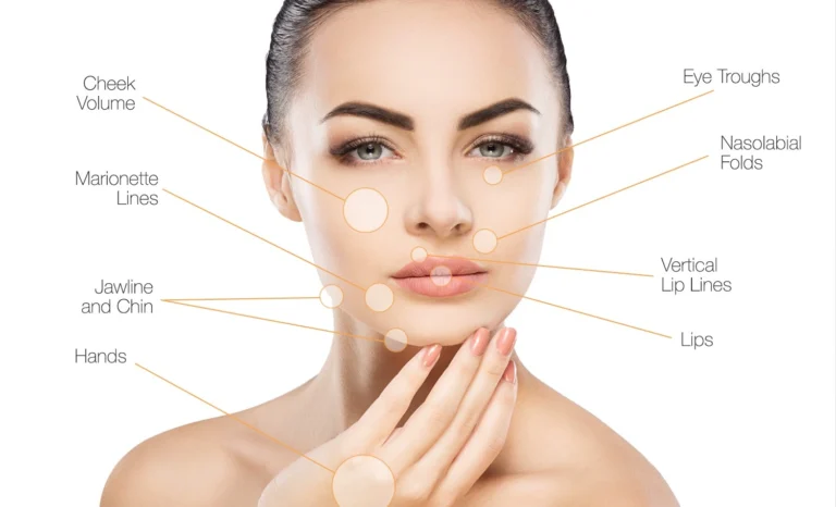 dermal fillers area