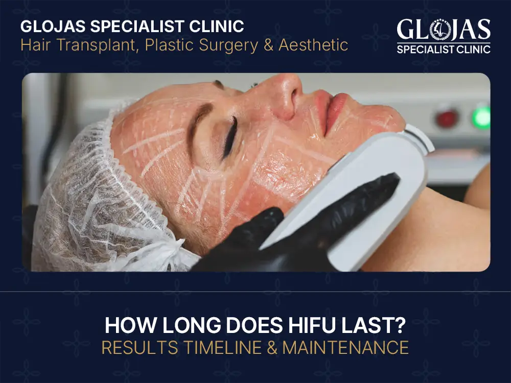 how long does hifu last