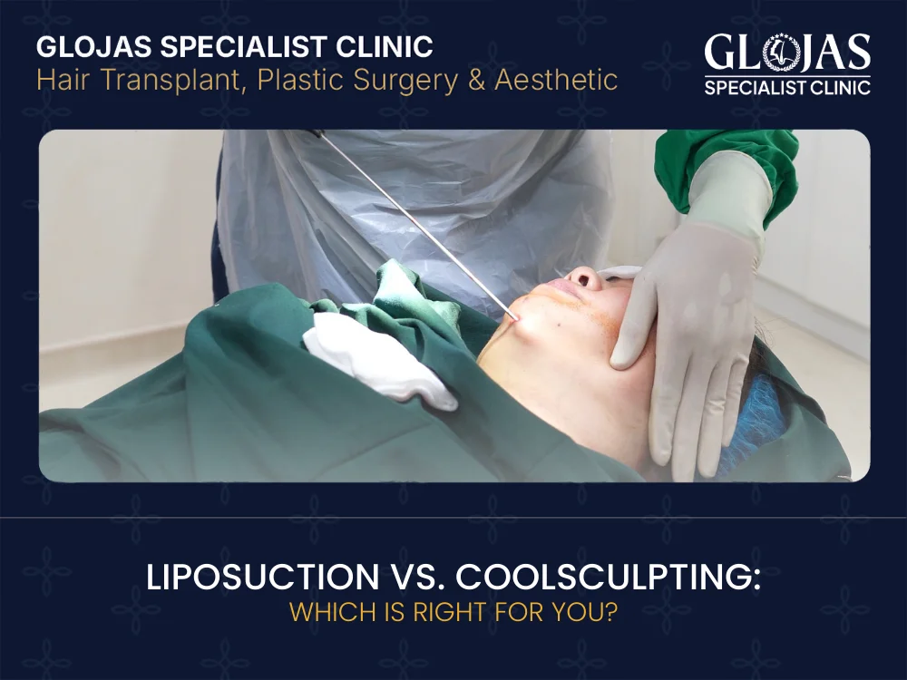 liposuction-vs-coolsculpting