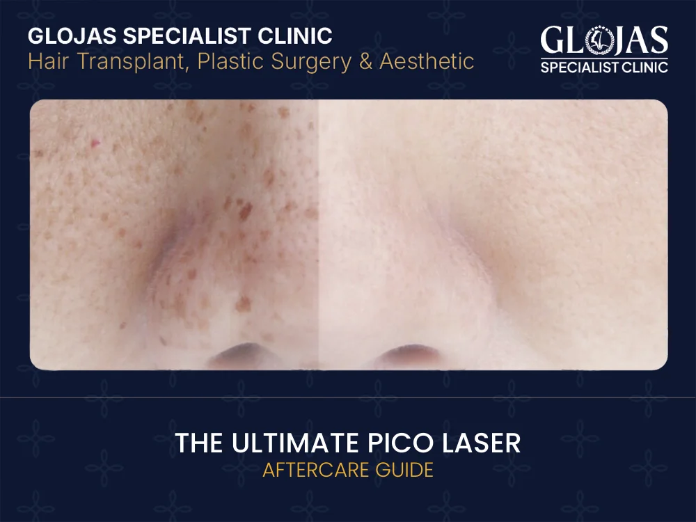 The Ultimate Pico Laser Aftercare Guide 5 pico-laser-aftercare