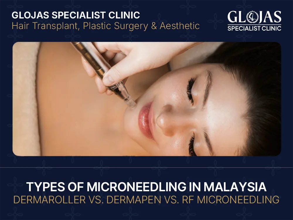 Types of Microneedling: Dermaroller vs. Dermapen vs. RF Microneedling 10 types of microneedling in malaysia
