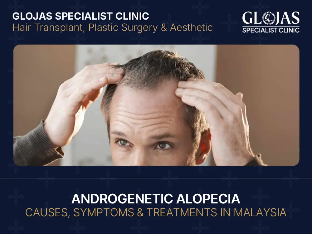 Androgenetic Alopecia