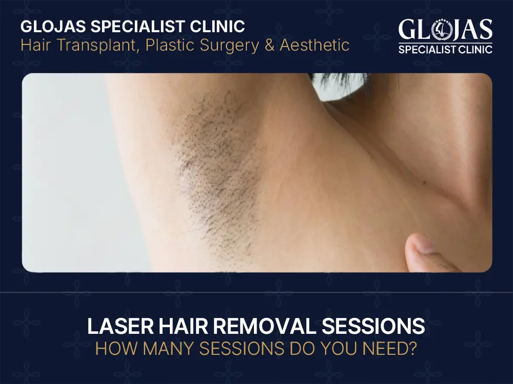 laser hair removal sessions