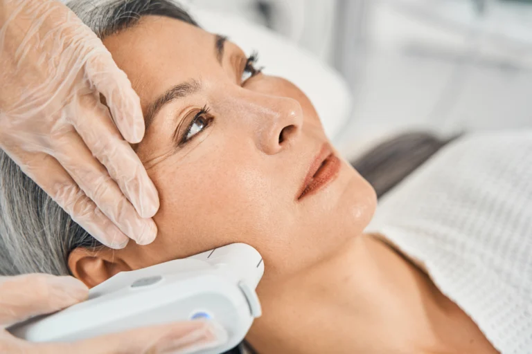 HIFU treatment lifting sagging skin on the jawline