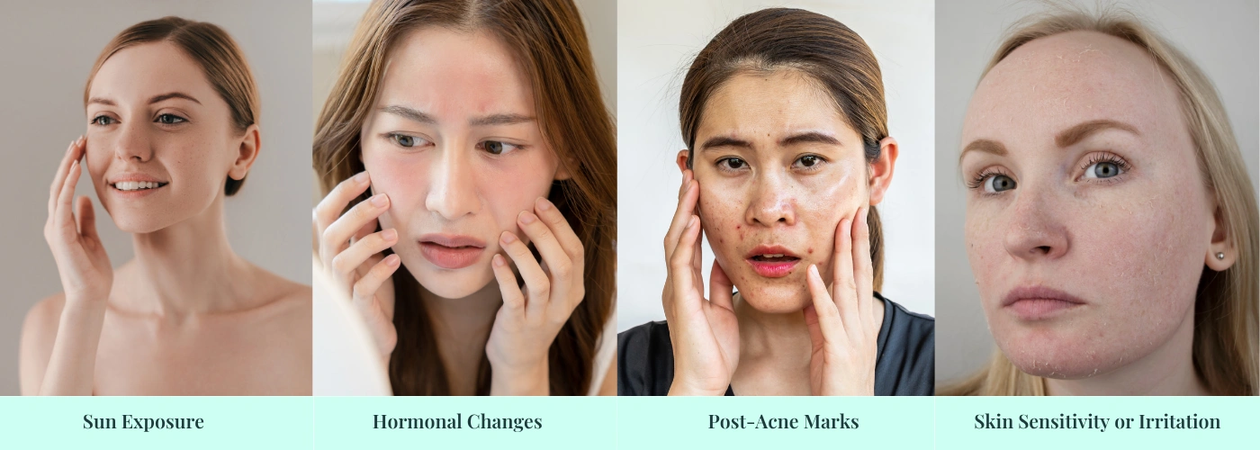 Pigmentation treatment banner | Glojas Aesthetic