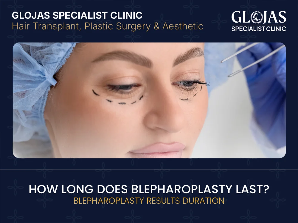 blepharoplasty-results-duration