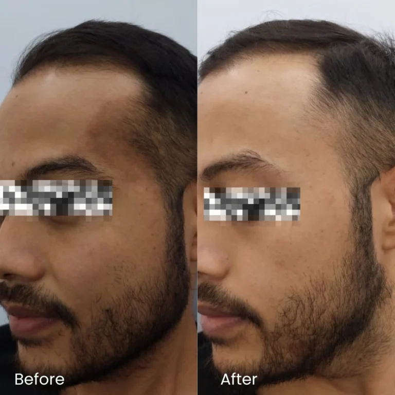 Pigmentation Treatment Ads 5 pigmentation_review2