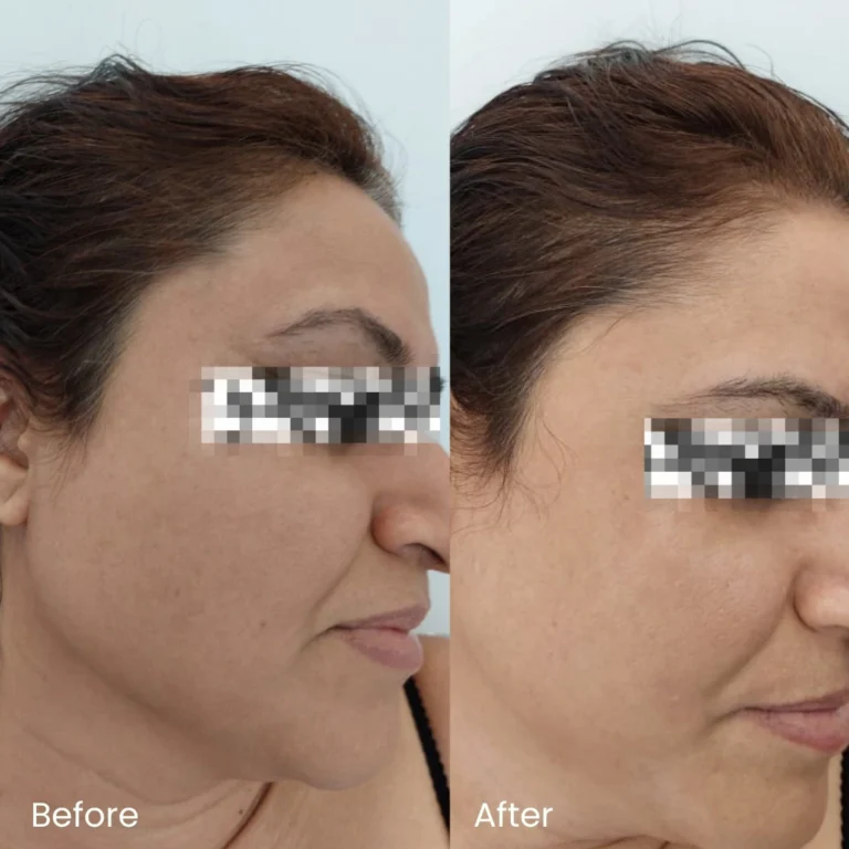 Pigmentation Treatment Ads 6 pigmentation_review3