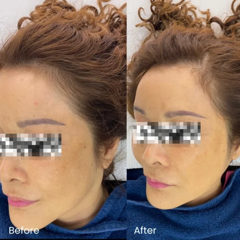 Pigmentation Treatment Ads 7 pigmentation_review4