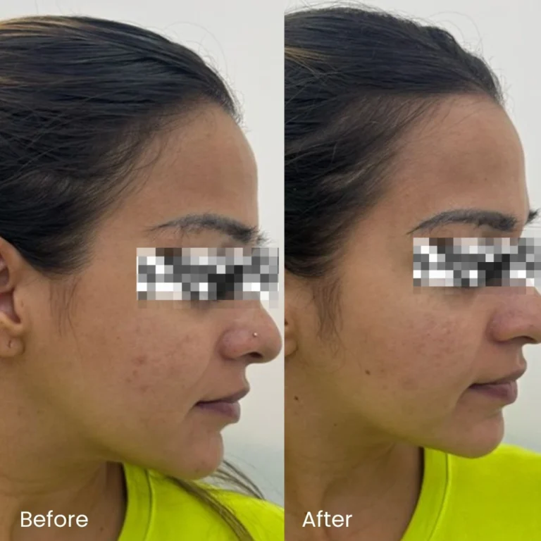 Pigmentation Treatment Ads 8 pigmentation_review5