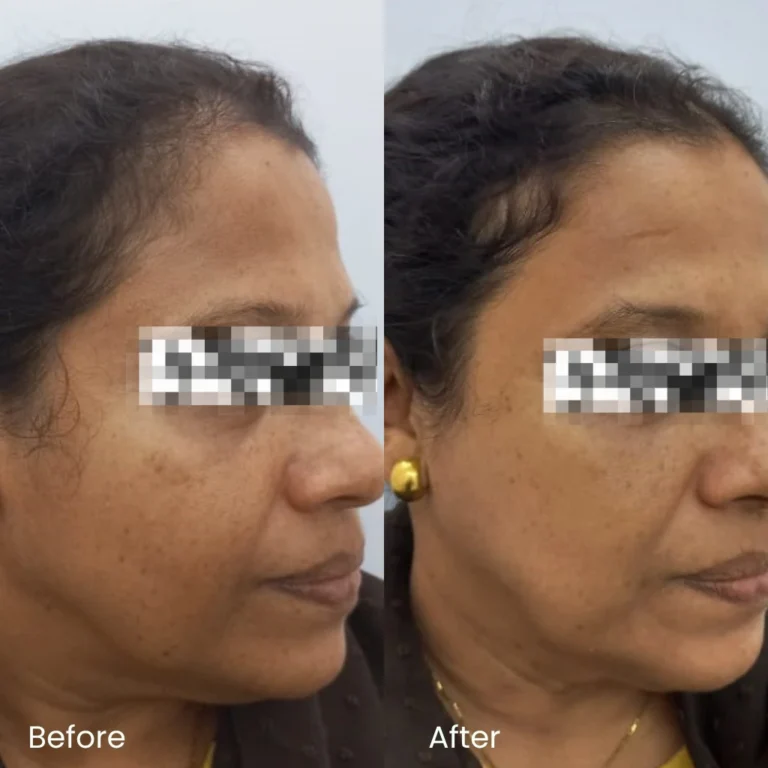 Pigmentation Treatment Ads 9 pigmentation_review6