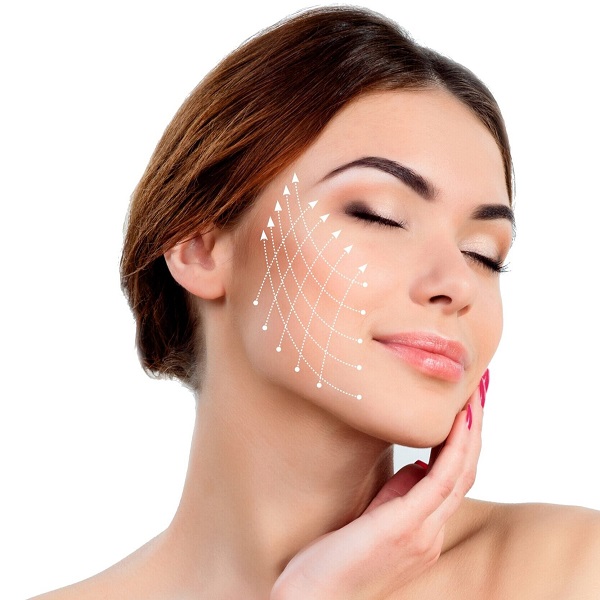 Non-surgical Face-Lift with PDO Thread Lift