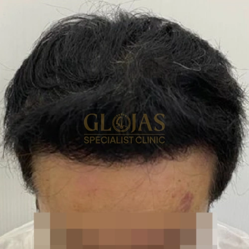 After