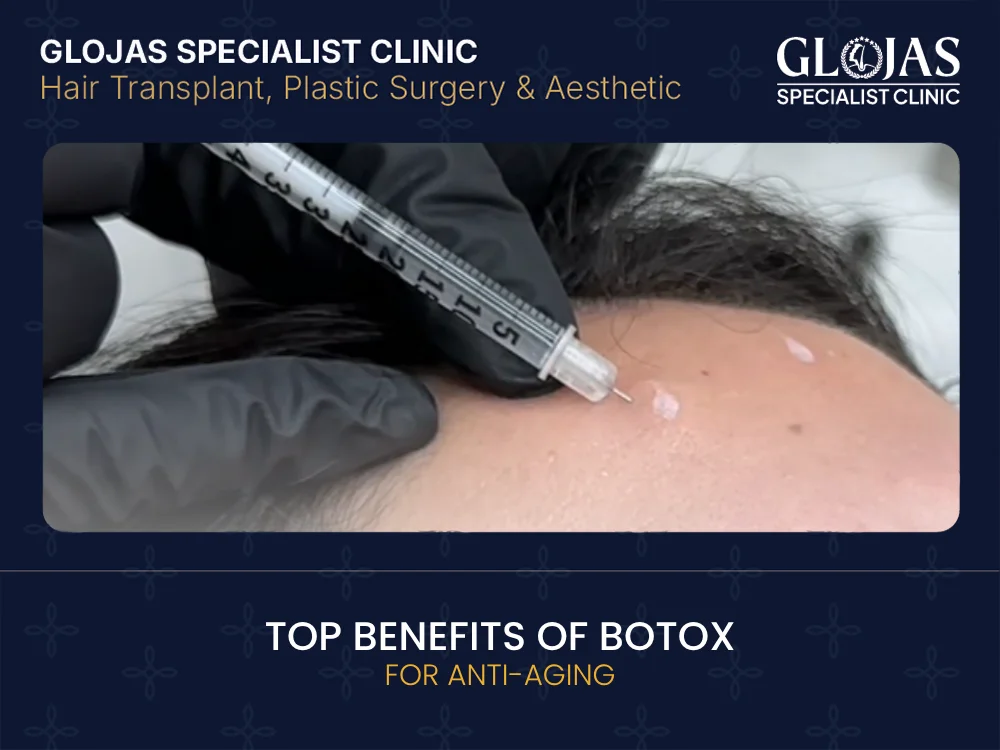 benefits-of-botox