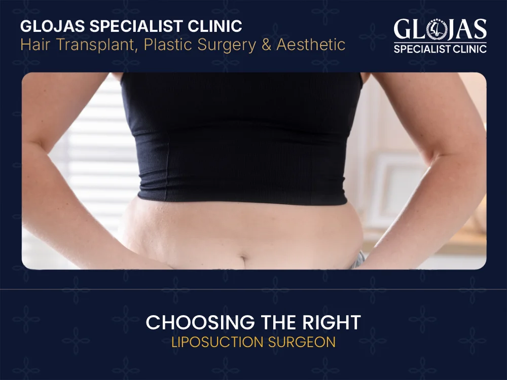 choose-liposuction-surgeon