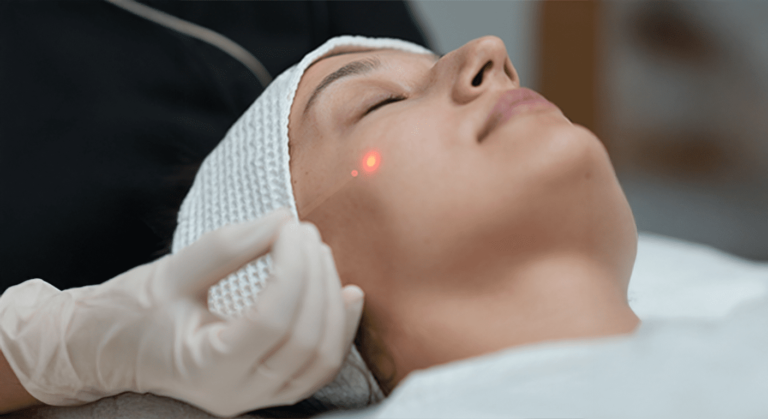 endolift laser