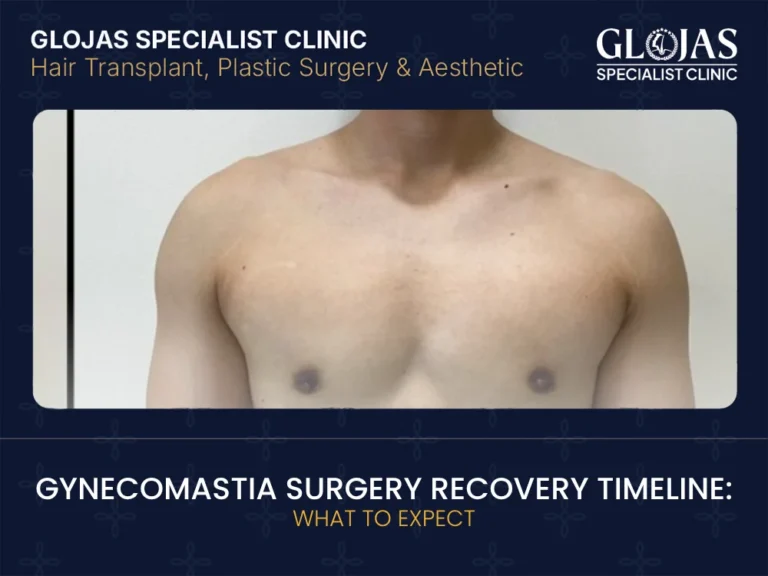 gynecomastia-surgery-recovery