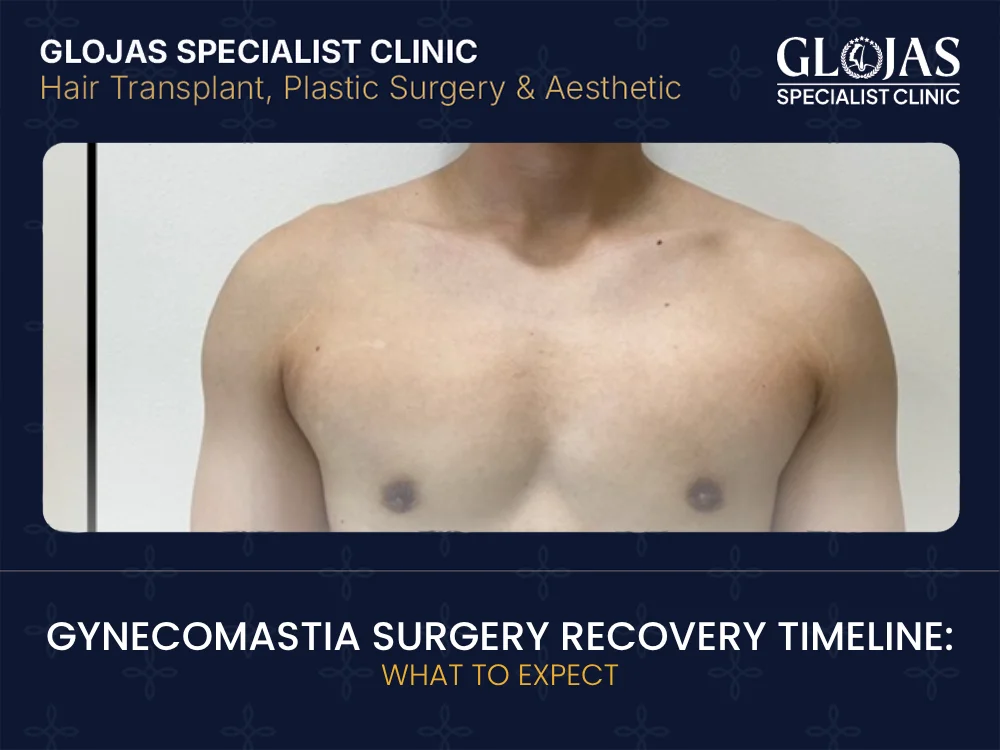 gynecomastia-surgery-recovery