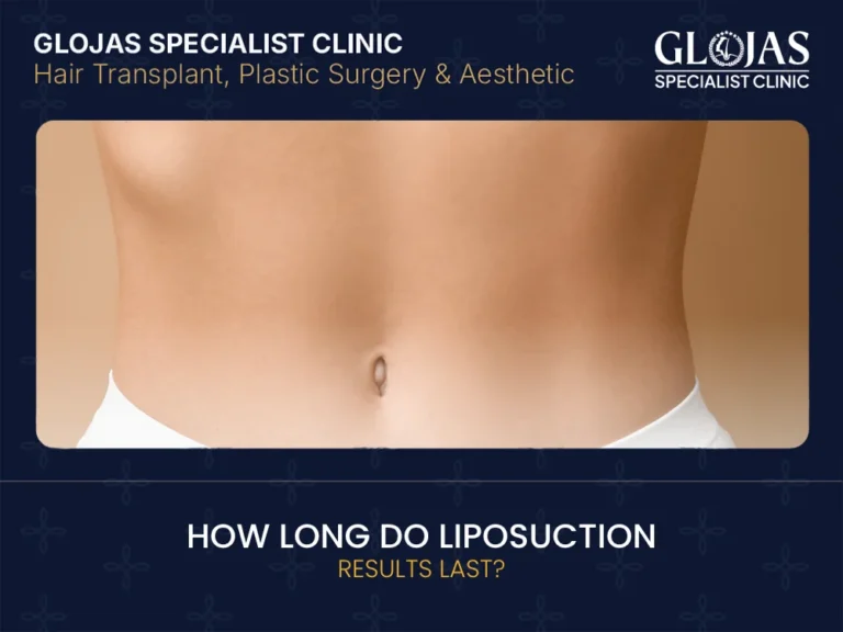 Blogs 19 liposuction-results-duration