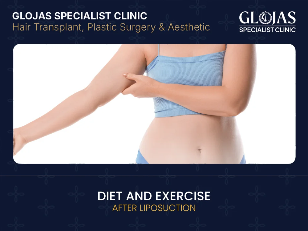 post-liposuction-diet-exercise