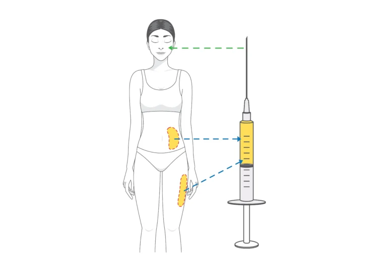 fat transfer injection
